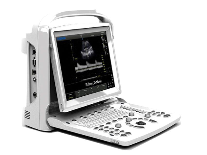 Ecogramma Chison Eco3 - Ecografo - – MepMedika